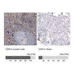 Atlas Antibodies Anti-VSIR Antibody