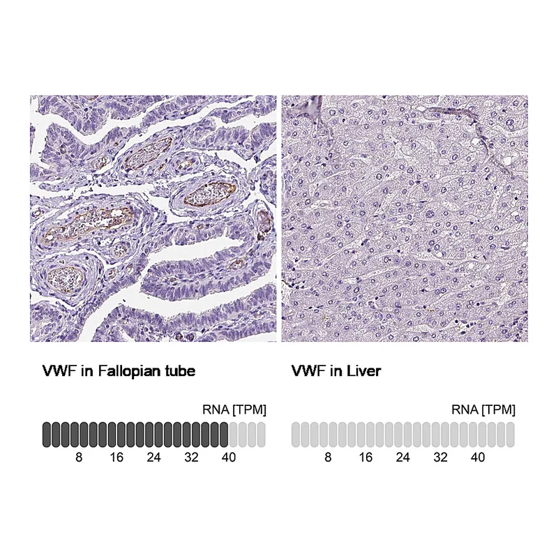 Atlas Antibodies Anti-VWF Antibody