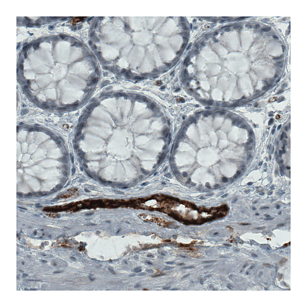 Atlas Antibodies Anti-VWF Antibody