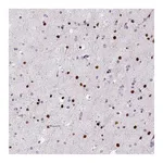Atlas Antibodies Anti-ZEB1 Antibody