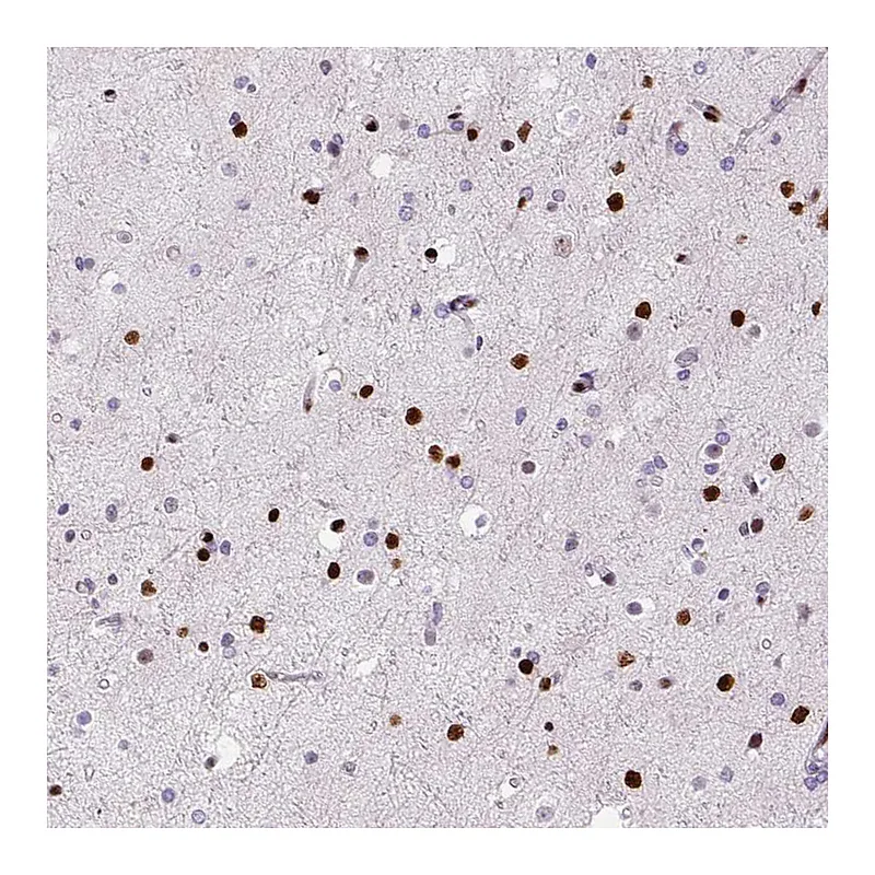 Atlas Antibodies Anti-ZEB1 Antibody
