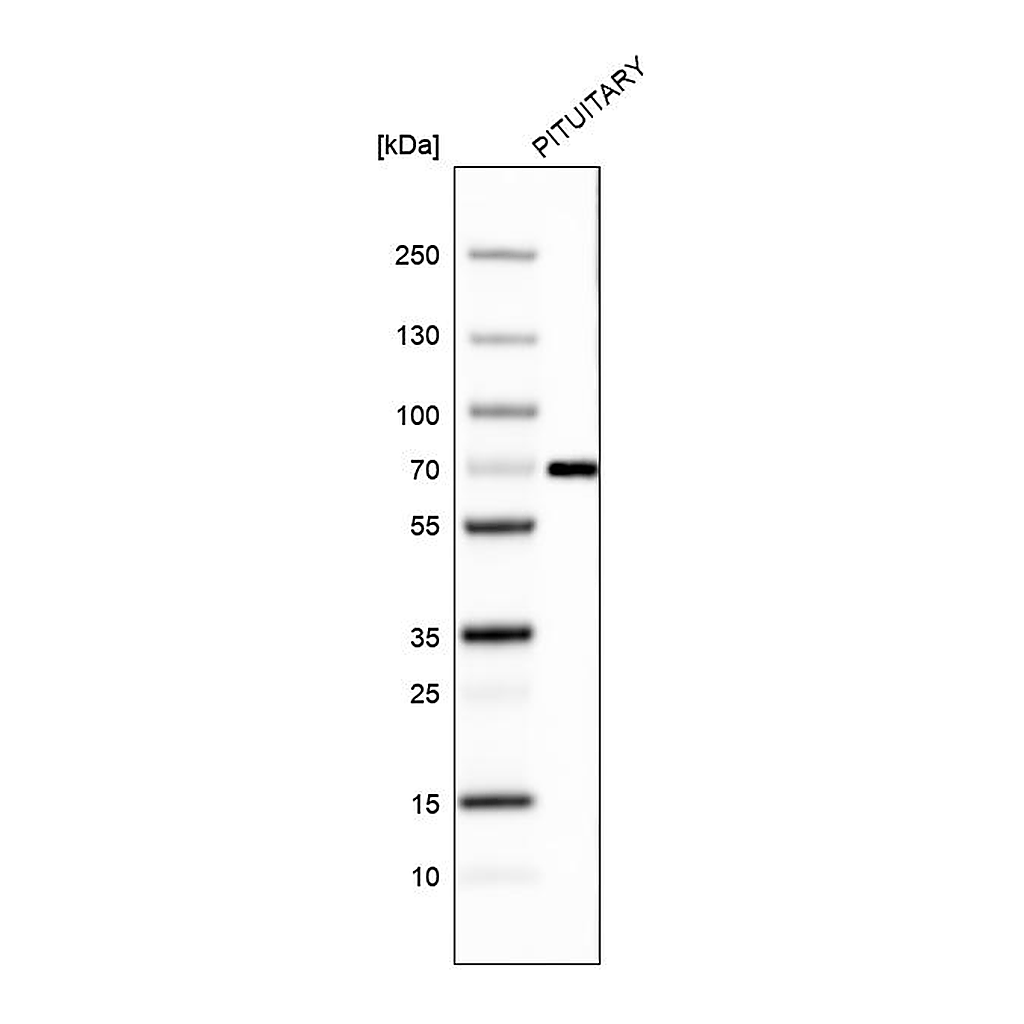 Atlas Antibodies Anti-ZNF10 Antibody