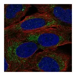 Atlas Antibodies Anti-A4GALT Antibody