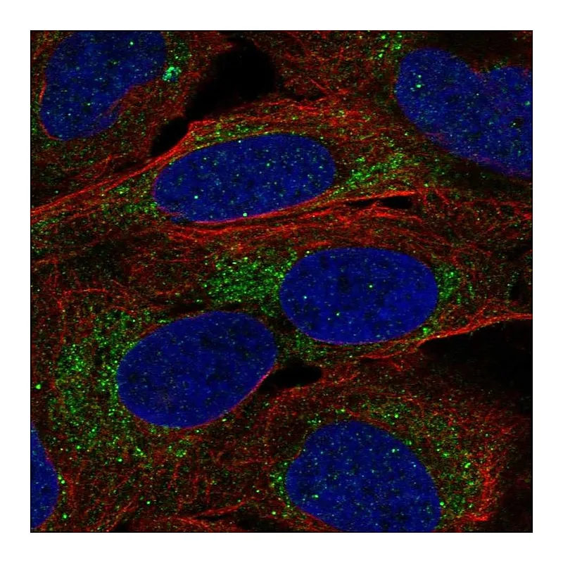 Atlas Antibodies Anti-A4GALT Antibody