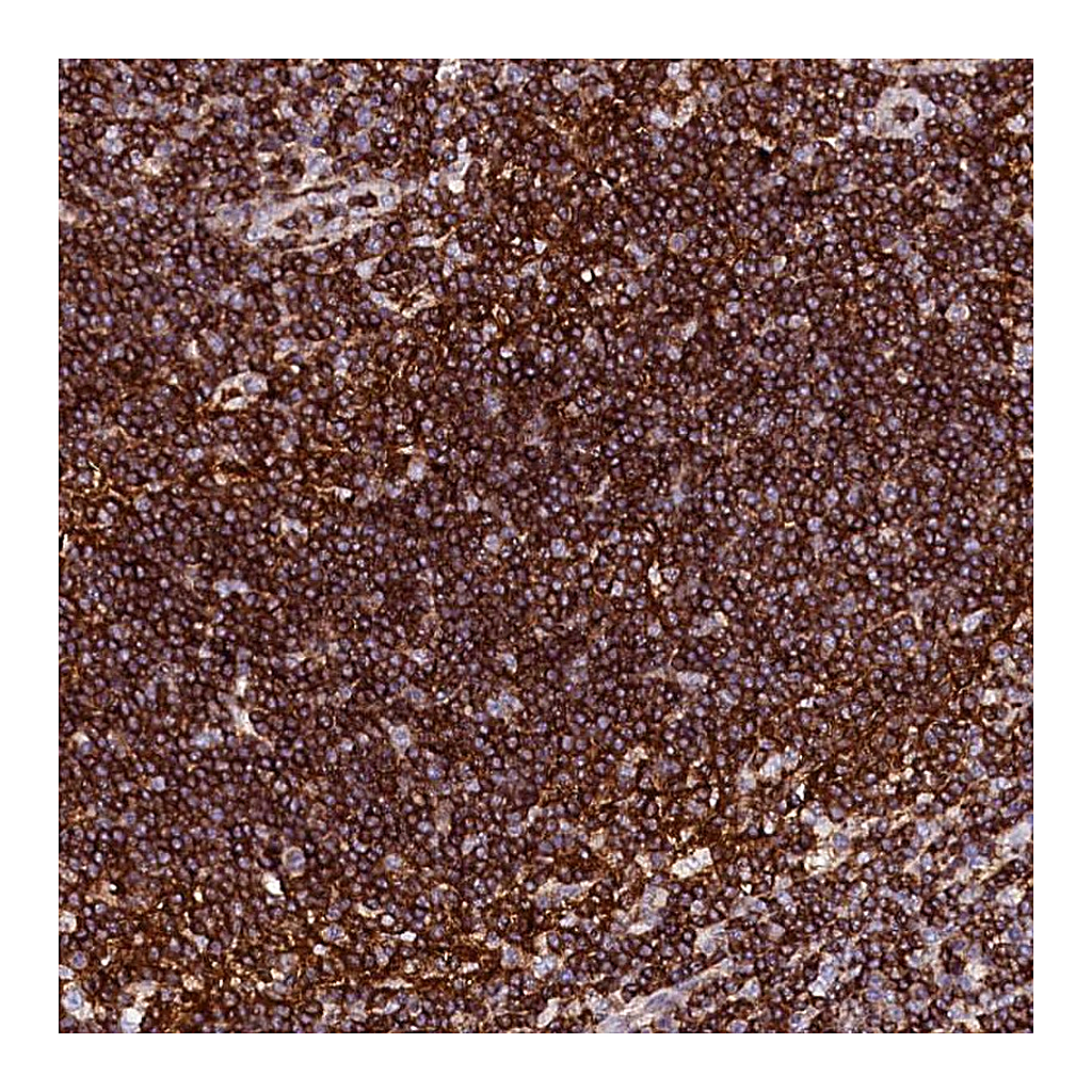 Atlas Antibodies Anti-AAAS Antibody