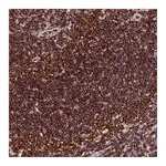 Atlas Antibodies Anti-AAAS Antibody