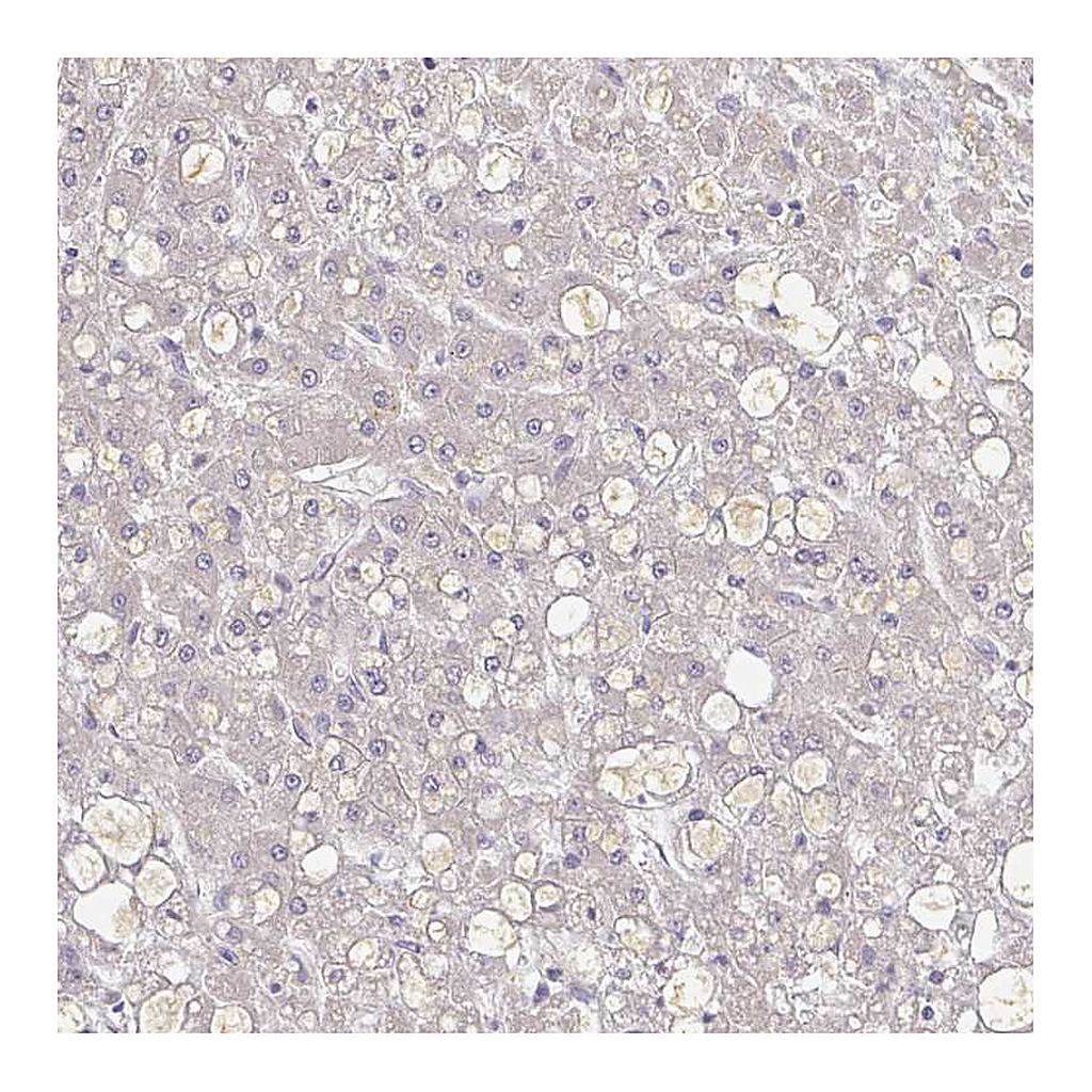 Atlas Antibodies Anti-A1BG Antibody