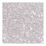 Atlas Antibodies Anti-A1BG Antibody