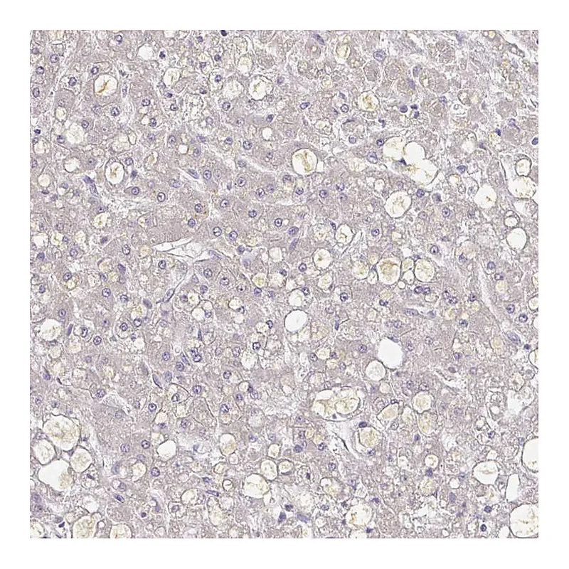 Atlas Antibodies Anti-A1BG Antibody