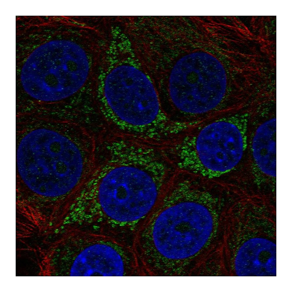 Atlas Antibodies Anti-A4GALT Antibody