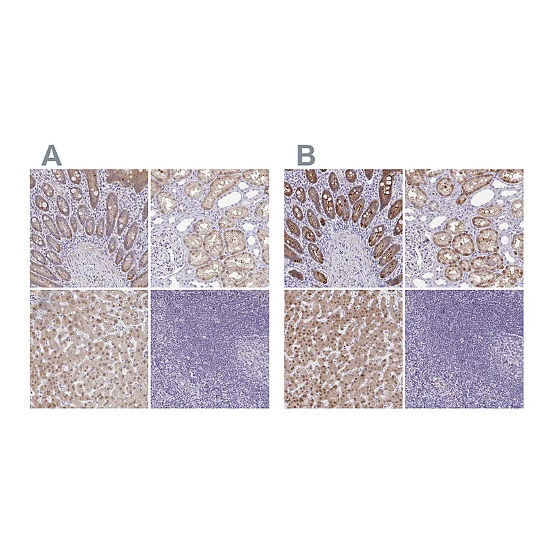 Atlas Antibodies Anti-A1CF Antibody