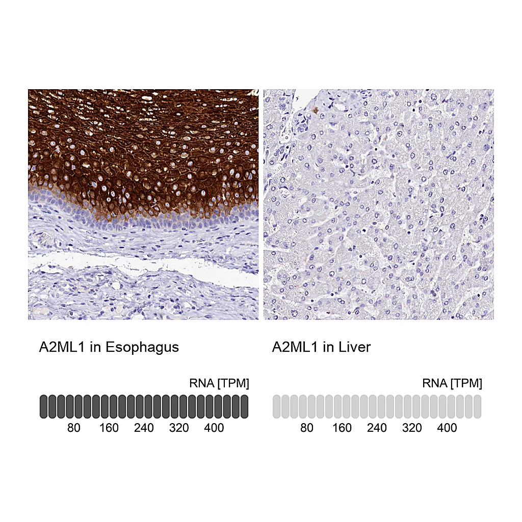 Atlas Antibodies Anti-A2ML1 Antibody