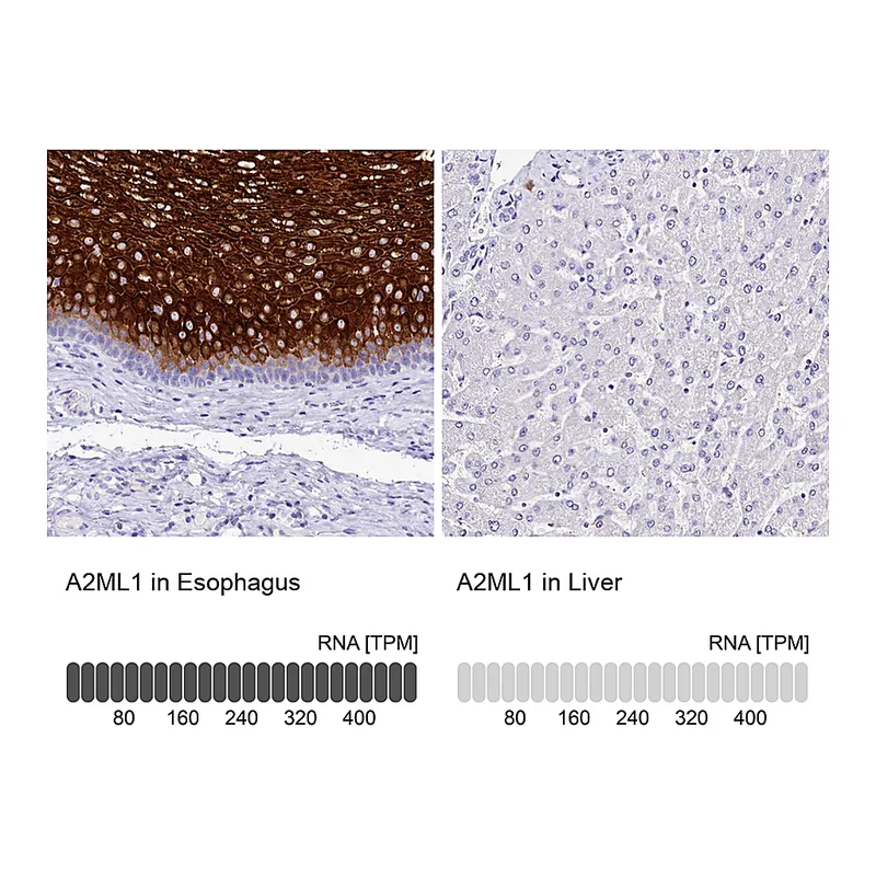 Atlas Antibodies Anti-A2ML1 Antibody