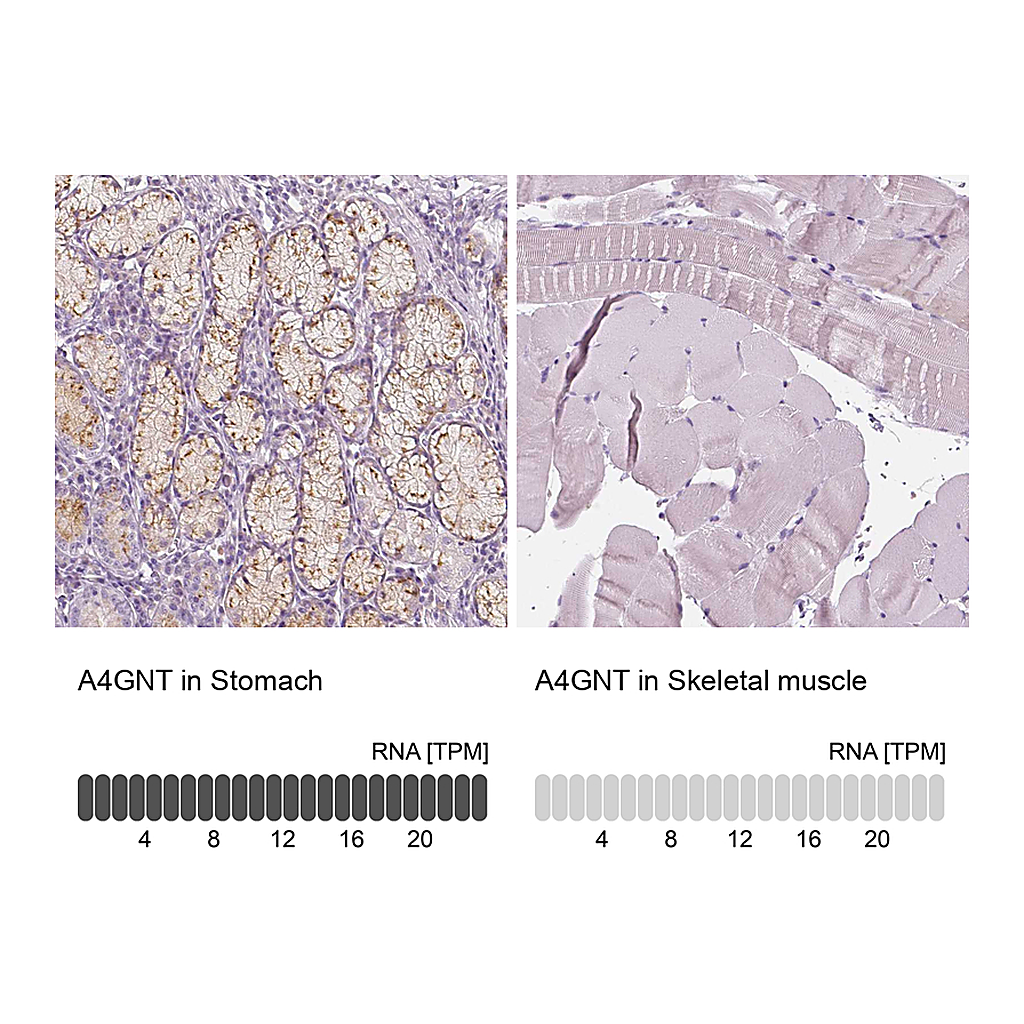Atlas Antibodies Anti-A4GNT Antibody