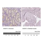 Atlas Antibodies Anti-A4GNT Antibody