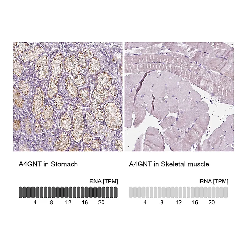 Atlas Antibodies Anti-A4GNT Antibody