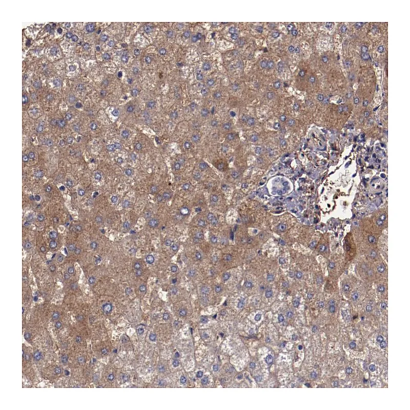 Atlas Antibodies Anti-A2M Antibody