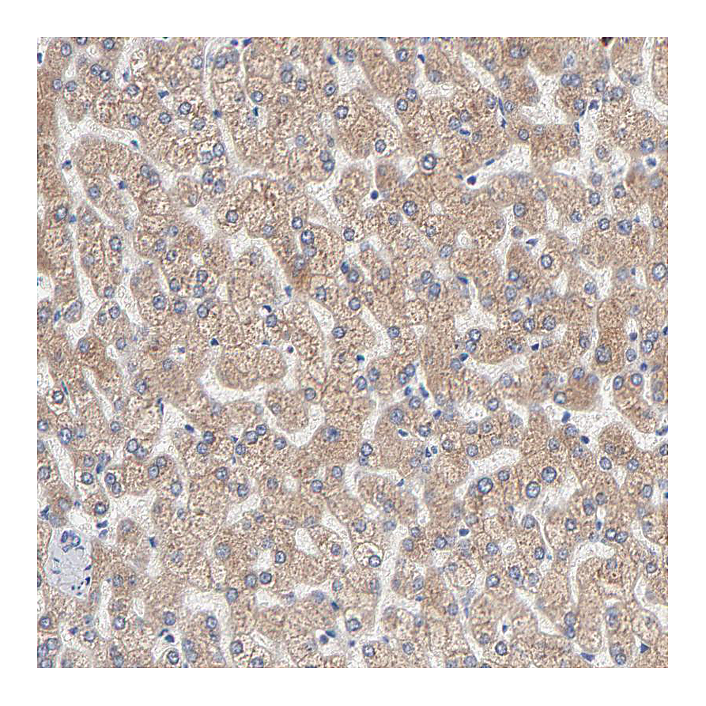 Atlas Antibodies Anti-AADAC Antibody