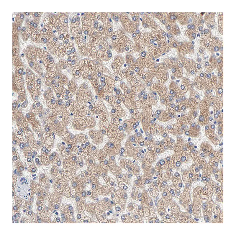Atlas Antibodies Anti-AADAC Antibody