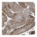 Atlas Antibodies Anti-AAED1 Antibody