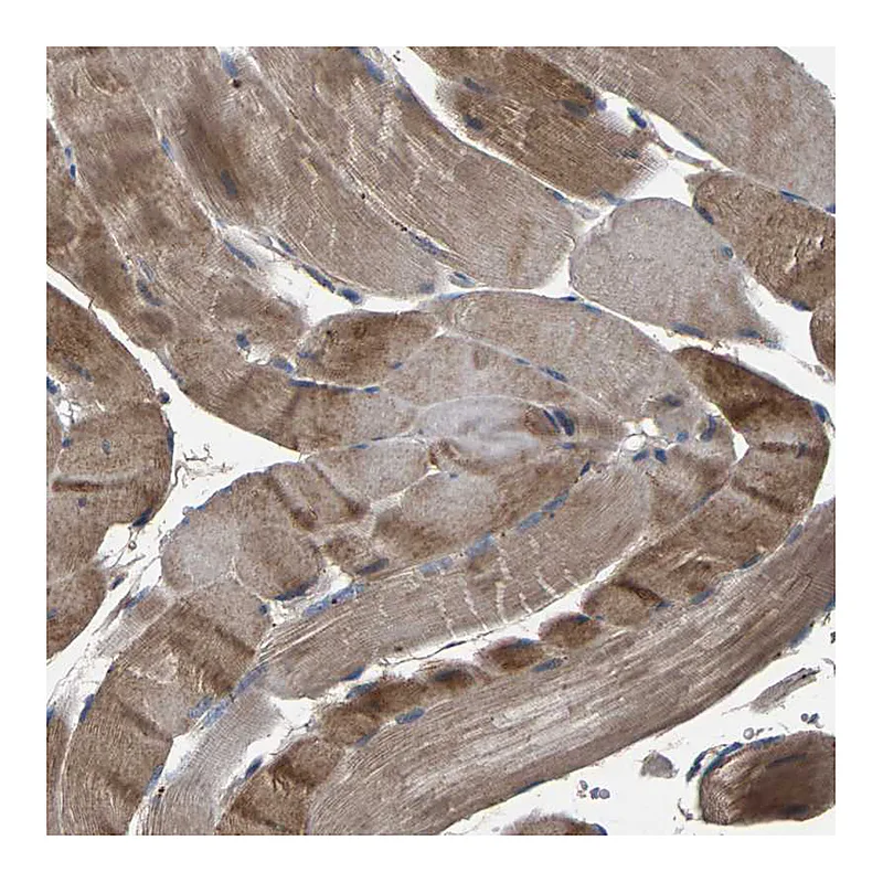 Atlas Antibodies Anti-AAED1 Antibody