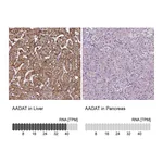 Atlas Antibodies Anti-AADAT Antibody
