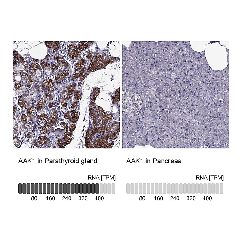 Atlas Antibodies Anti-AAK1 Antibody