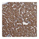 Atlas Antibodies Anti-AAGAB Antibody