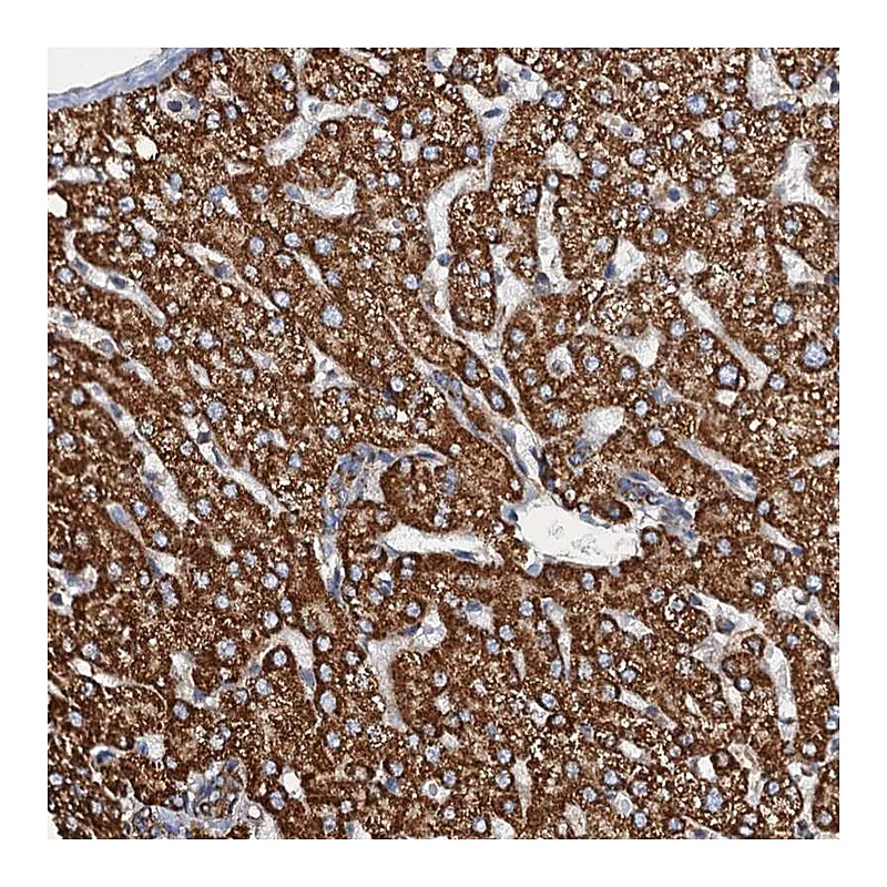 Atlas Antibodies Anti-AAGAB Antibody