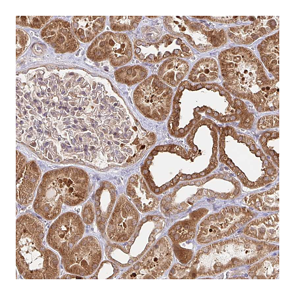 Atlas Antibodies Anti-AACS Antibody