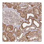Atlas Antibodies Anti-AACS Antibody