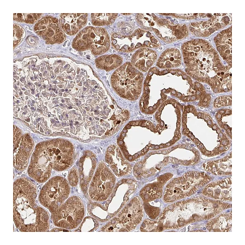 Atlas Antibodies Anti-AACS Antibody