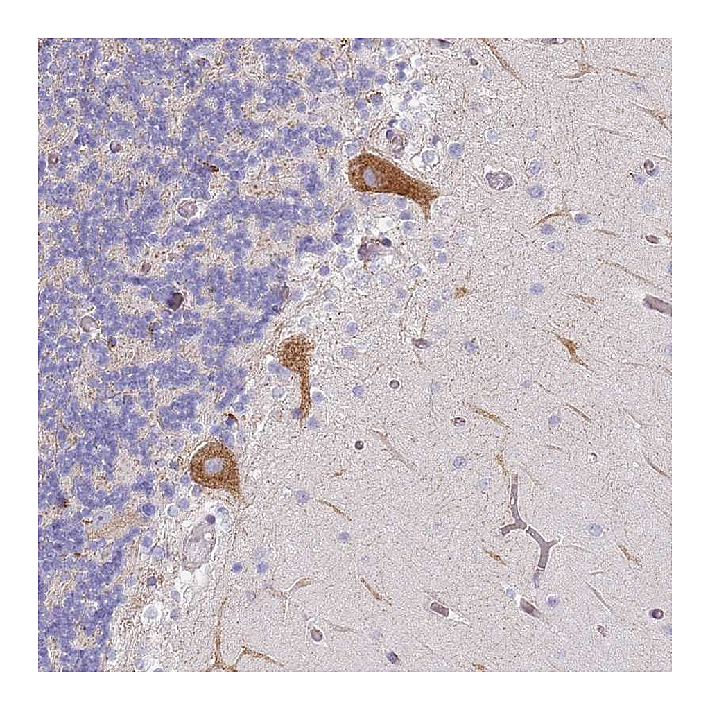 Atlas Antibodies Anti-AADACL4 Antibody