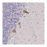 Atlas Antibodies Anti-AADACL4 Antibody