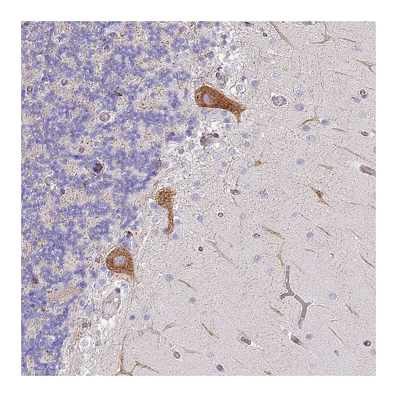 Atlas Antibodies Anti-AADACL4 Antibody