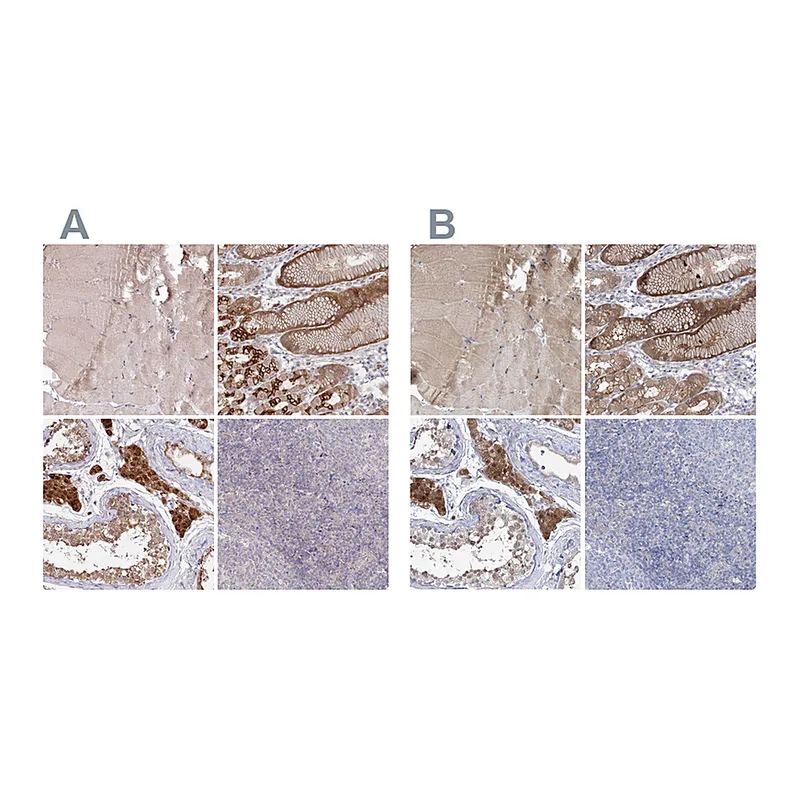 Atlas Antibodies Anti-AAMDC Antibody