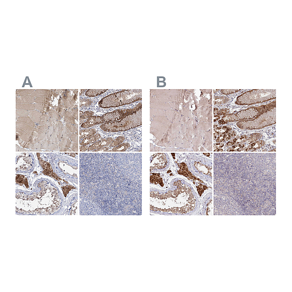 Atlas Antibodies Anti-AAMDC Antibody