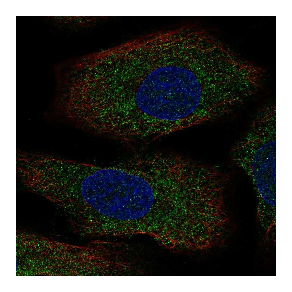 Atlas Antibodies Anti-AANAT Antibody