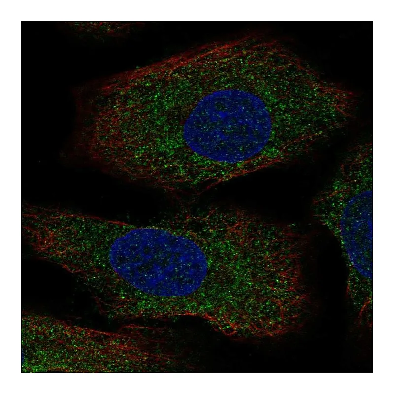 Atlas Antibodies Anti-AANAT Antibody