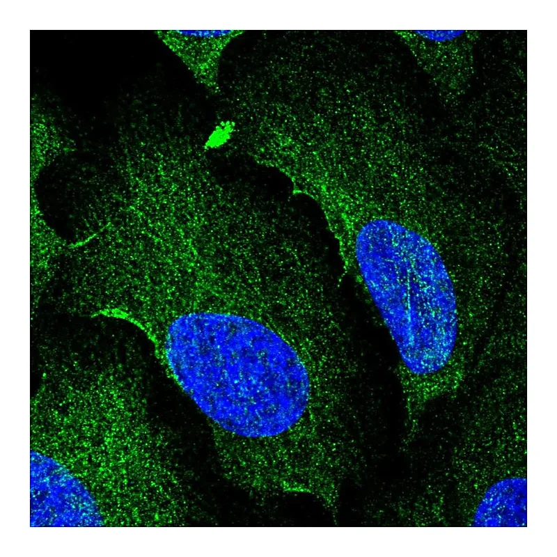 Atlas Antibodies Anti-AAMP Antibody