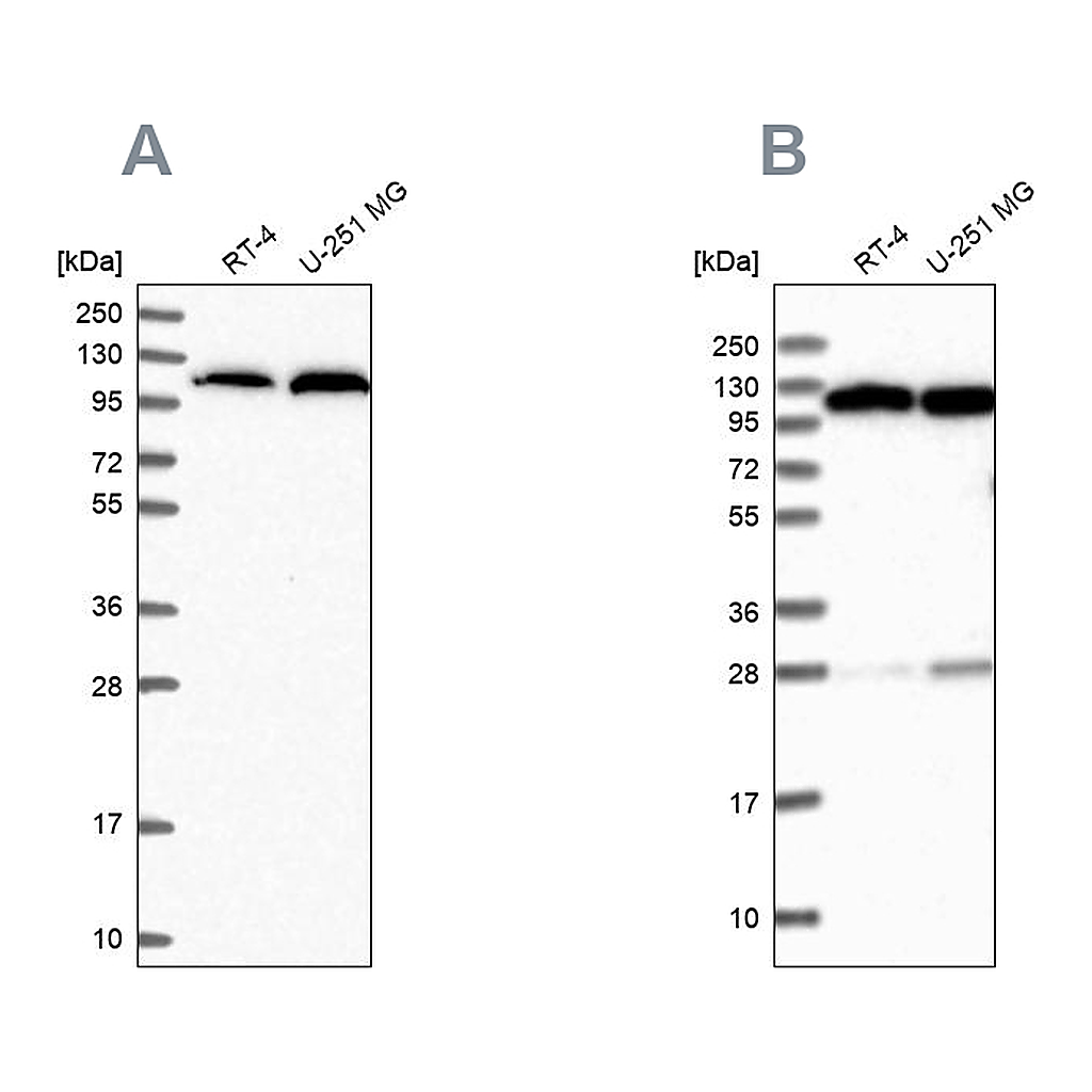 Atlas Antibodies Anti-AARS Antibody