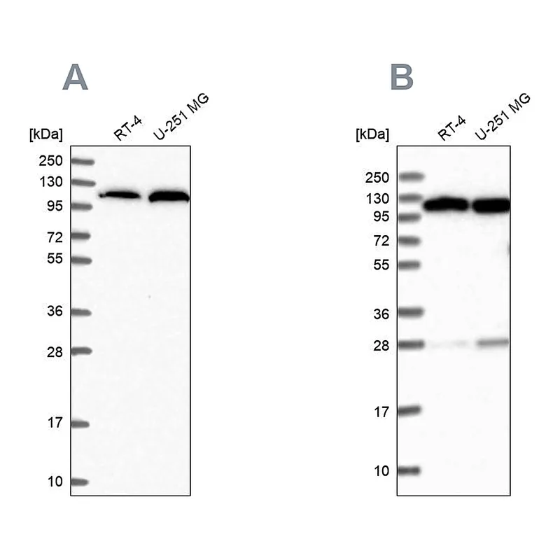 Atlas Antibodies Anti-AARS Antibody