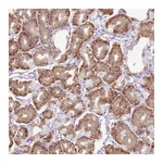 Atlas Antibodies Anti-AAR2 Antibody