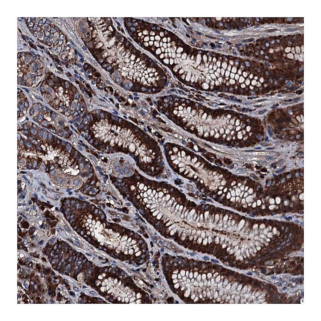 Atlas Antibodies Anti-AARS Antibody