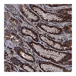 Atlas Antibodies Anti-AARS Antibody