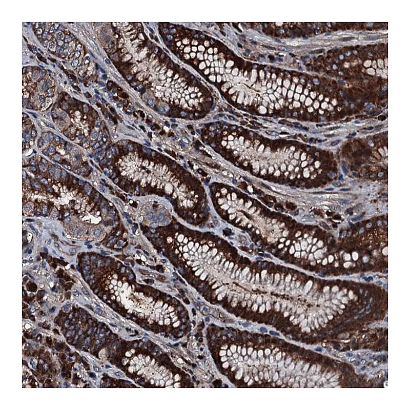 Atlas Antibodies Anti-AARS Antibody
