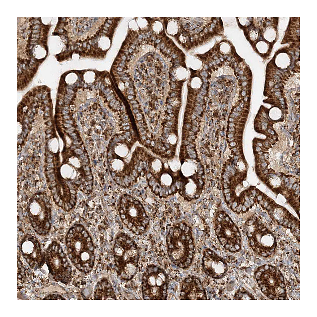 Atlas Antibodies Anti-AARS2 Antibody
