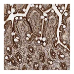 Atlas Antibodies Anti-AARS2 Antibody