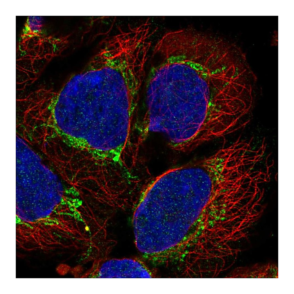 Atlas Antibodies Anti-AARS2 Antibody