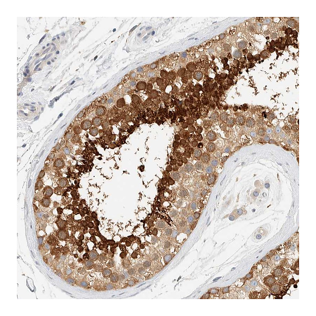 Atlas Antibodies Anti-AARSD1 Antibody